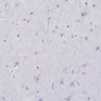 Immunohistochemical staining of human cerebral cortex shows no positivity in neurons as expected.
