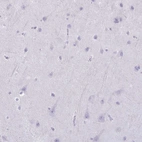 Immunohistochemical staining of human cerebral cortex shows no positivity in neurons as expected.
