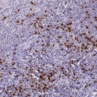 Immunohistochemical staining of human tonsil shows strong granular cytoplasmic positivity in non-germinal center cells.