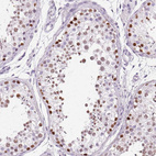 Anti-SP7 Antibody