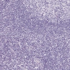 Immunohistochemical staining of human Tonsil shows no positivity in non-germinal center cells as expected.