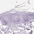Immunohistochemical staining of human Skin shows no positivity in squamous epithelial cells as expected.