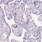 Immunohistochemical staining of human Placenta shows no positivity in trophoblastic cells as expected.