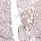 Anti-SMARCB1 Antibody