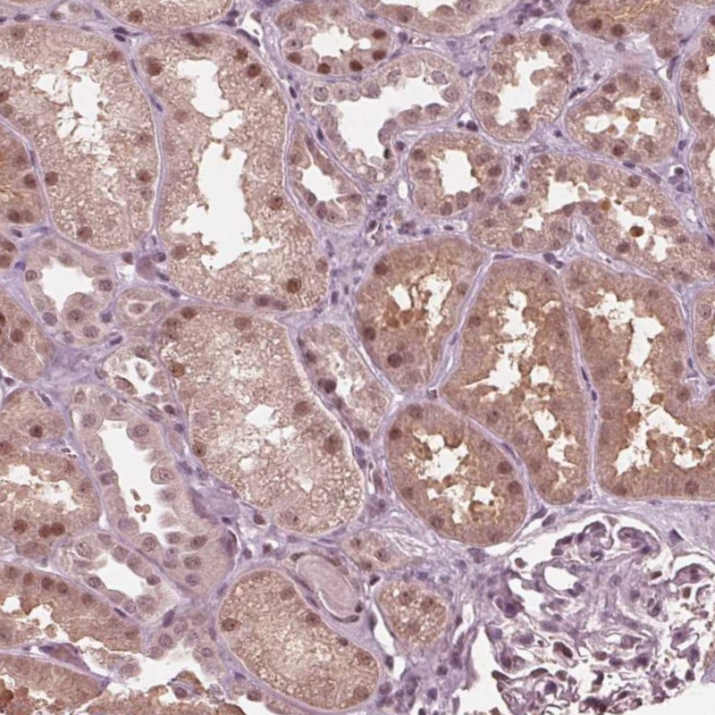 Anti-HIRIP3 Antibody