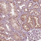 Anti-HIRIP3 Antibody