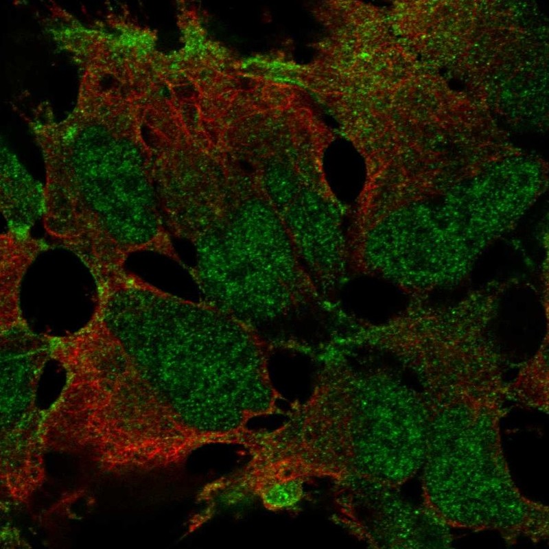 Anti-ZNF560 Antibody