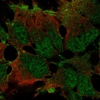 Anti-ZNF560 Antibody