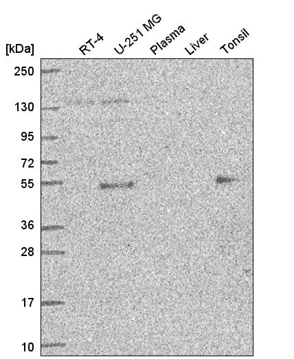 Anti-ETS1 Antibody