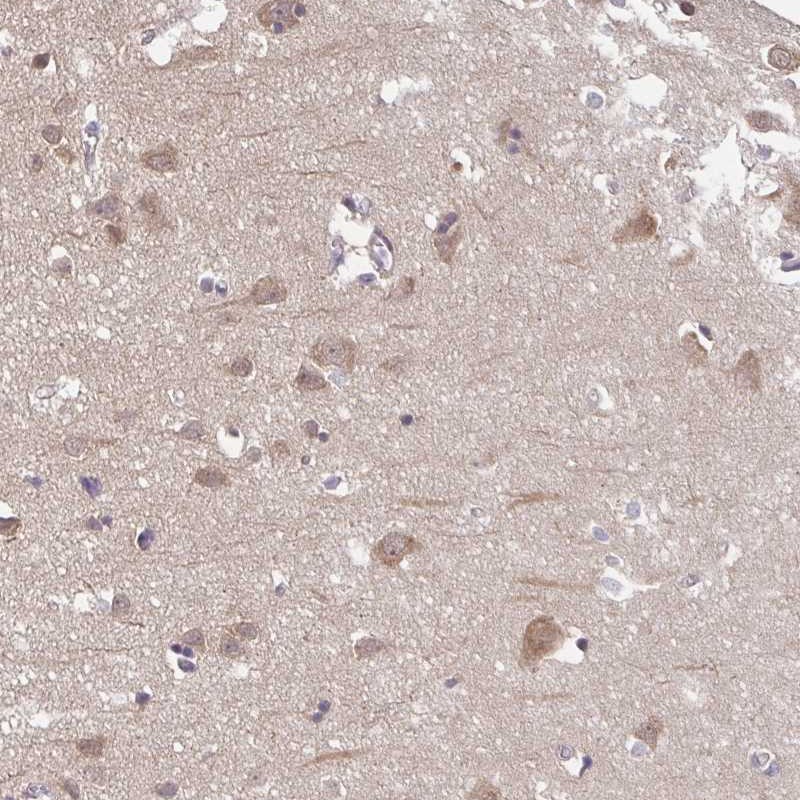 Anti-PREPL Antibody
