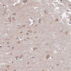 Anti-PREPL Antibody