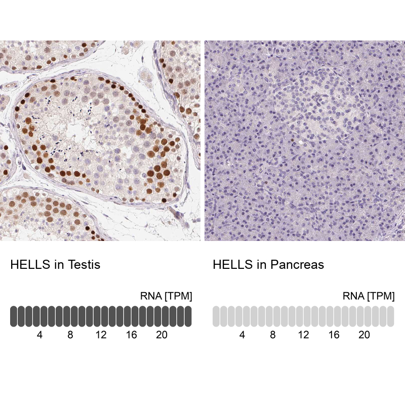 Anti-HELLS Antibody