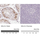 Anti-HELLS Antibody