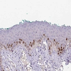 Immunohistochemical staining of human skin shows moderate nuclear positivity in squamous epithelial cells.