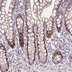 Immunohistochemical staining of human small intestine shows moderate nuclear positivity in glandular cells.