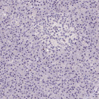 Immunohistochemical staining of human pancreas shows no positivity as expected.
