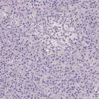 Immunohistochemical staining of human pancreas shows no positivity as expected.