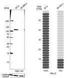 Western blot analysis in human cell lines RT-4 and SK-BR-3 using Anti-HELLS antibody. Corresponding HELLS RNA-seq data are presented for the same cell lines. Loading control: Anti-COX4I1.