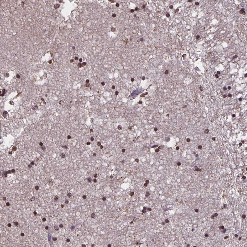 Anti-MARCH6 Antibody