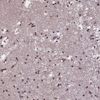 Anti-MARCH6 Antibody