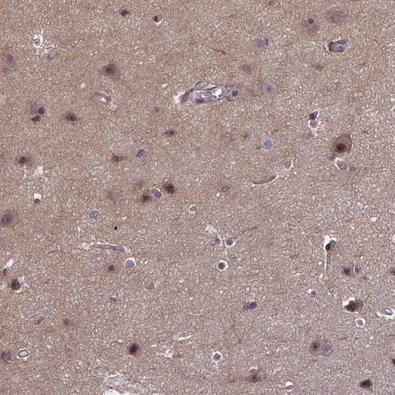 Anti-DNAJB1 Antibody