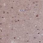 Anti-DNAJB1 Antibody