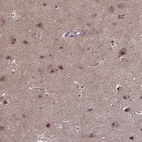 Anti-DNAJB1 Antibody