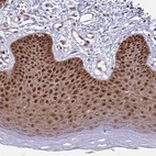 Immunohistochemical staining of human skin shows strong nuclear positivity in squamous epithelial cells.