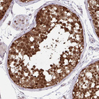 Immunohistochemical staining of human testis shows strong nuclear and cytoplasmic positivity in cells in seminiferous ducts.