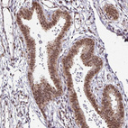 Immunohistochemical staining of human fallopian tube shows moderate nuclear positivity in glandular cells.