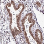 Immunohistochemical staining of human fallopian tube shows moderate nuclear positivity in glandular cells.