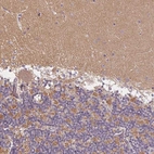 Anti-GDAP1L1 Antibody