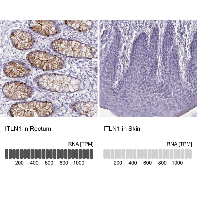 Anti-ITLN1 Antibody