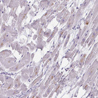 Immunohistochemical staining of human heart muscle shows weak cytoplasmic-membranous positivity in cardiomyocytes.