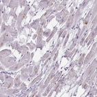 Immunohistochemical staining of human heart muscle shows weak cytoplasmic-membranous positivity in cardiomyocytes.
