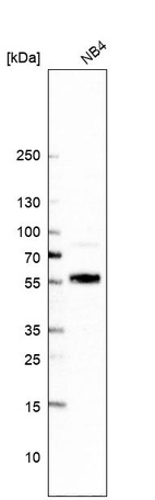 Anti-UNCX Antibody