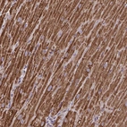 Immunohistochemical staining of human heart muscle shows high expression.