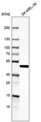 Western blot analysis in human cell line SK-MEL-30.