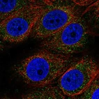Immunofluorescent staining of human cell line MCF7 shows localization to cytosol.