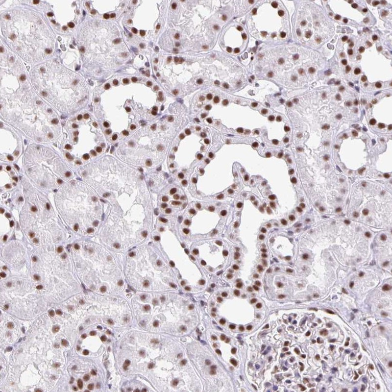Anti-ZRANB2 Antibody