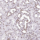 Anti-ZRANB2 Antibody