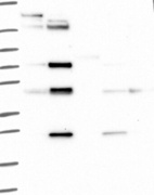 Anti-CD84 Antibody