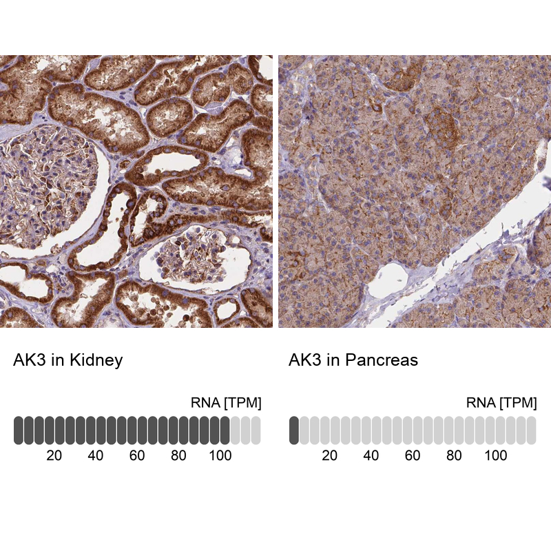 Anti-AK3 Antibody