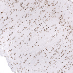 Anti-SMARCB1 Antibody