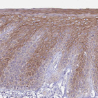 Rabbit Polyclonal Anti-CDKN2B Antibody - Buy for research