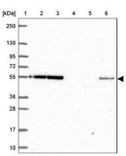 Lane 1: Marker [kDa] 250, 130, 95, 72, 55, 36, 28, 17, 10_br/_Lane 2: Human cell line RT-4_br/_Lane 3: Human cell line U-251 MG_br/_Lane 4: Human plasma_br/_Lane 5: Human Liver tissue_br/_Lane 6: Human Tonsil tissue
