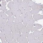 Immunohistochemical staining of human skeletal muscle shows very weak cytoplasmic positivity in myocytes.