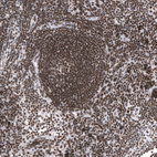 Immunohistochemical staining of human lymph node shows strong nuclear positivity in non-germinal and germinal center cells.