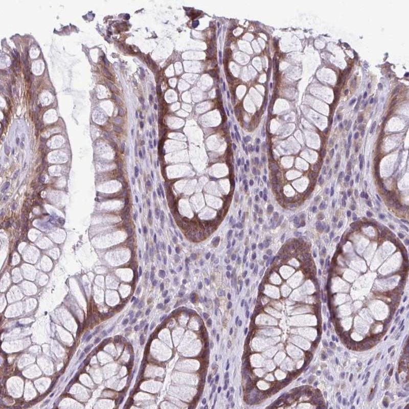 Anti-TMEM108 Antibody