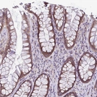 Anti-TMEM108 Antibody